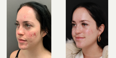 before and after image