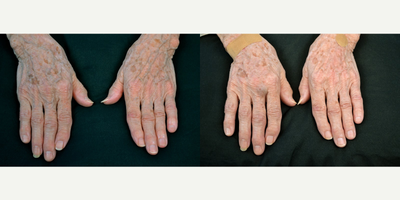before and after image