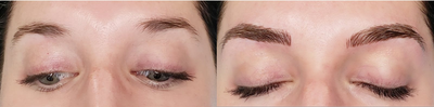 before and after image