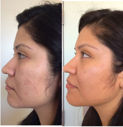 before and after image