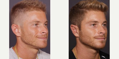 before and after image