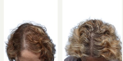before and after image