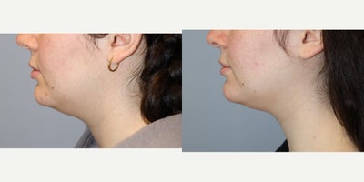 before and after image