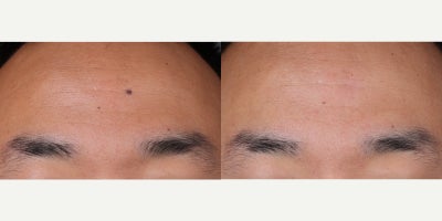 before and after image