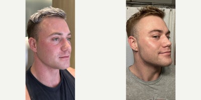 before and after image