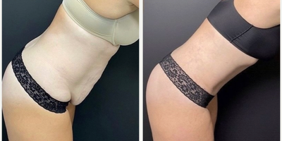 before and after image