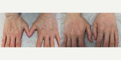 before and after image