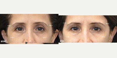 before and after image
