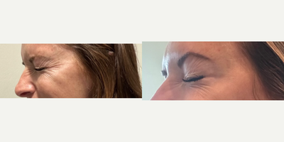 before and after image
