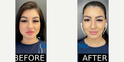before and after image