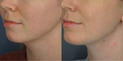 before and after image