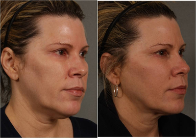 before and after image
