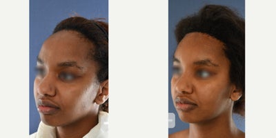 before and after image
