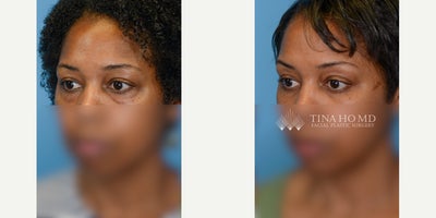 before and after image