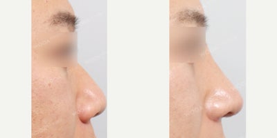 before and after image