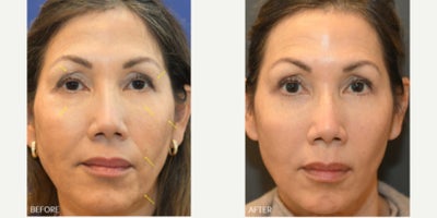 before and after image