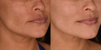 before and after image