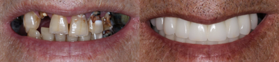 before and after image