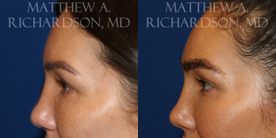 before and after image