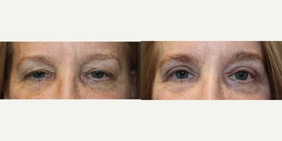 before and after image