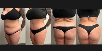before and after image