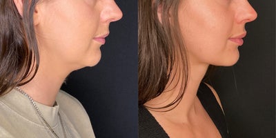 before and after image