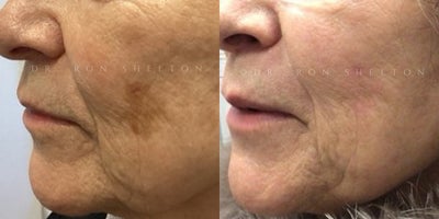 before and after image