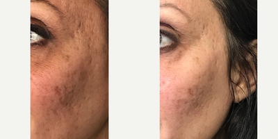 before and after image