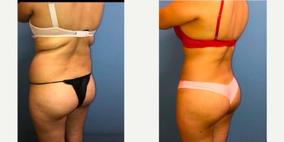before and after image