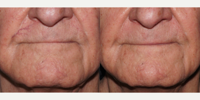 before and after image