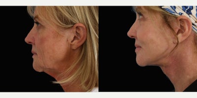 before and after image