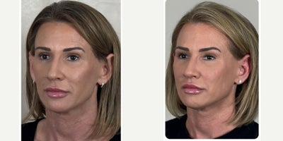 before and after image