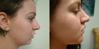 before and after image