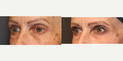 before and after image