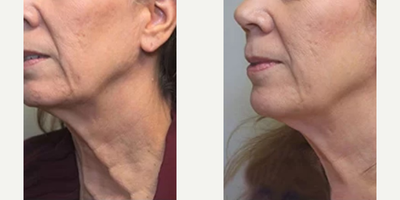 before and after image