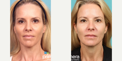 before and after image