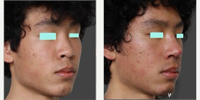 before and after image