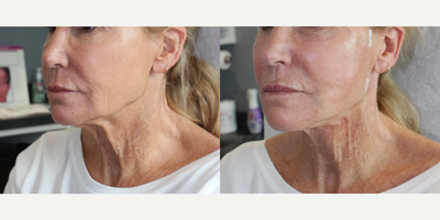 before and after image