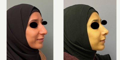 before and after image