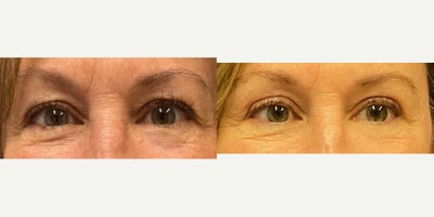 before and after image