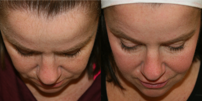 before and after image