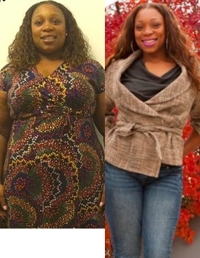 Lap Band before and after photo
