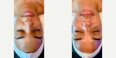 before and after image