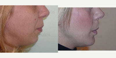 before and after image