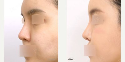 before and after image
