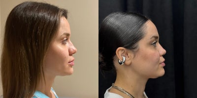 before and after image