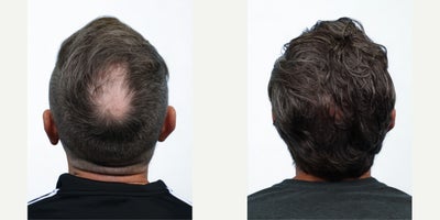before and after image
