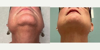 before and after image
