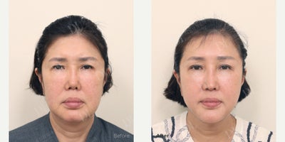 before and after image