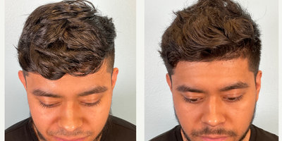 before and after image